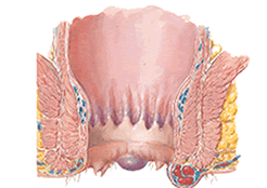 Fístula anal