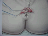 clinicadecoloproctologia
