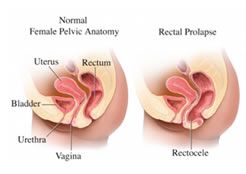 clinicadecoloproctologia
