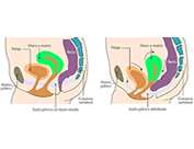 clinicadecoloproctologia